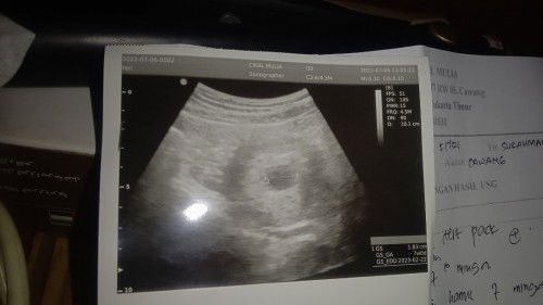 Minta doa nya ya bunda, semoga janin dalam rahim ku baik baik aja, semoga sehat terus ya bunda