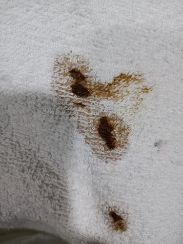 Saya sudah 7weeks..keluar darah coklat gelap. Adakah normal ?