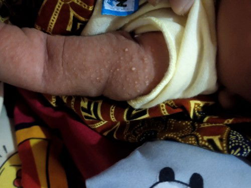 merah2 bercak kuning