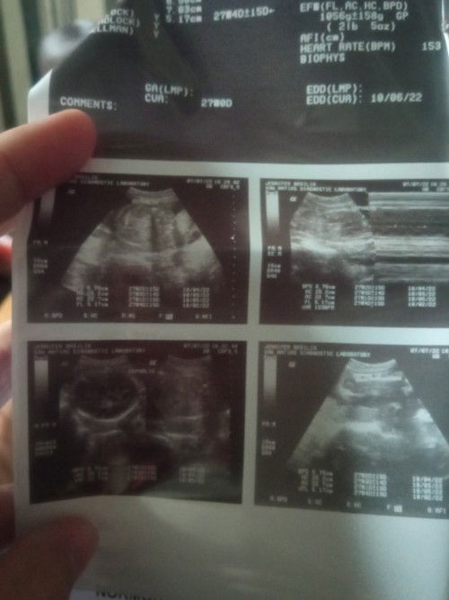 baby kong ayaw pakita ang gender