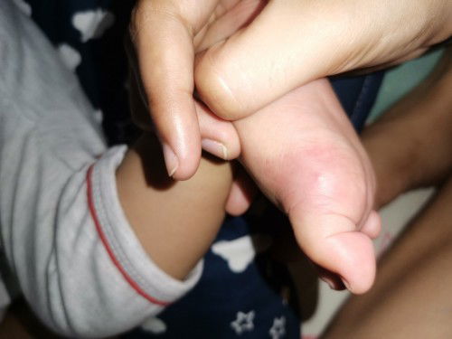 Hello. Ask ko lang po. Ano po kayang insekto ang nakakagat dito?