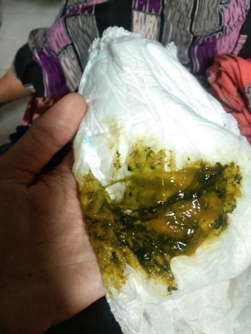 Bab bayi 4 bulan warna hijau tua berlendir