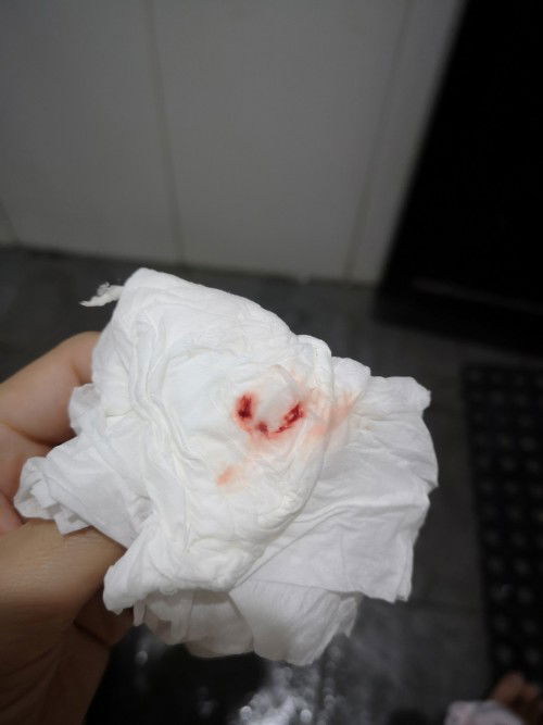 Flek di usia kandungan 6W