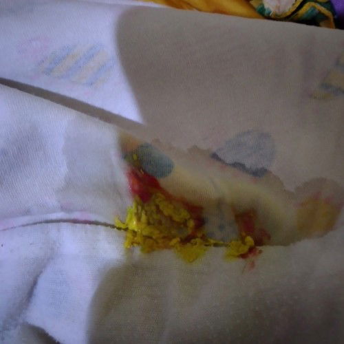 feses bayi newborn berdarah