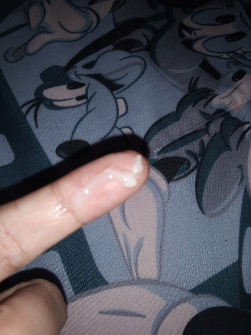 ตั้งครรภ์34+2week