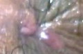 EXTERNAL ALMURANAS