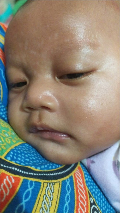 Bintik putih kaya panu