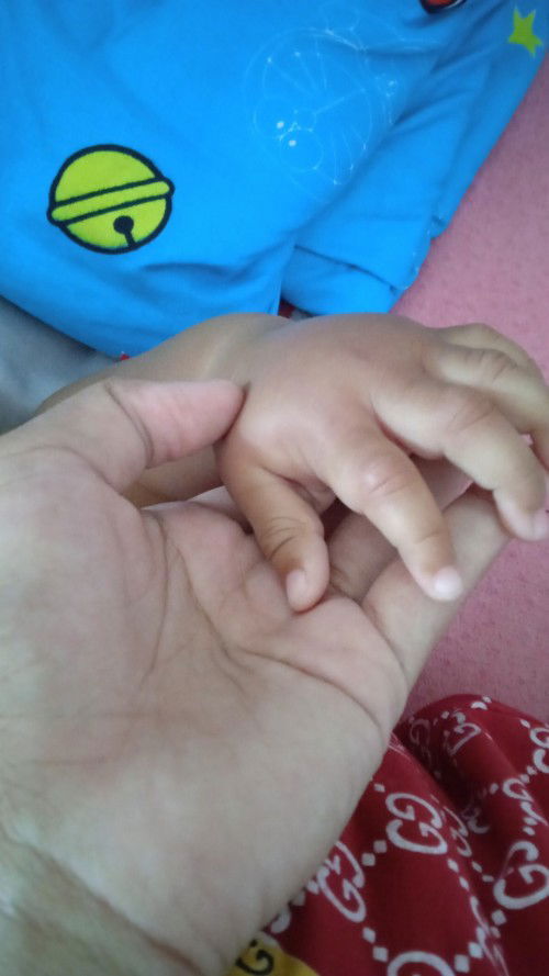 Tangan merah dan bengkak