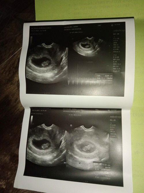 Nalilito parin po ako. What should i do po? Should i stop po ba na magschool? Or continue po ?