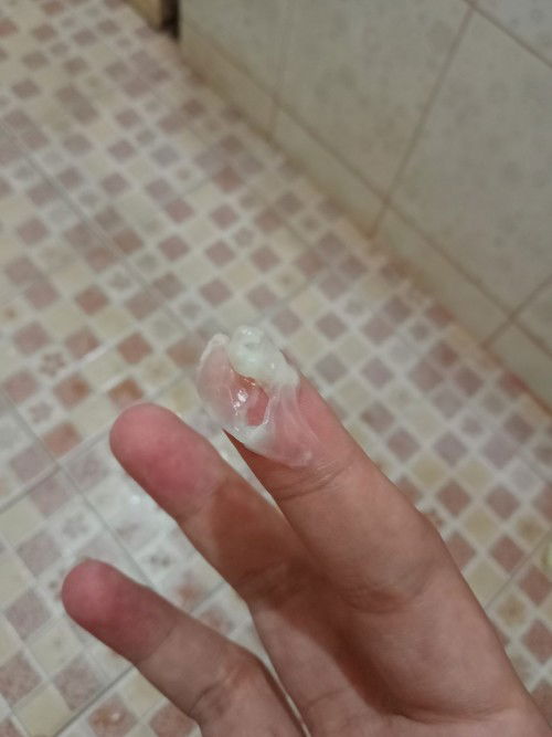 มูกขาว39+3สัปดาห์