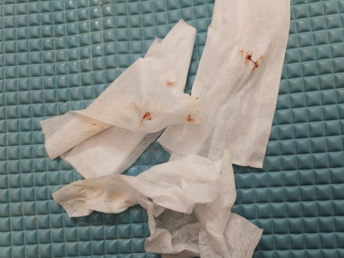 Muntah Susu campur Darah