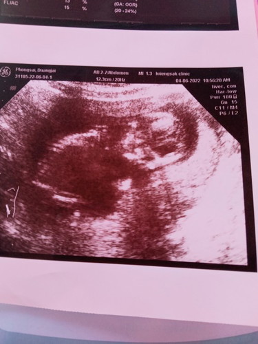 ขอทีม พฤศจิกายน ครับ ของแฟน คลอด 27 พฤศจิกายน 65