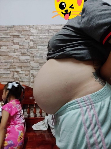 แบบนี้ท้องลดหรือยังค่ะ 34+2w