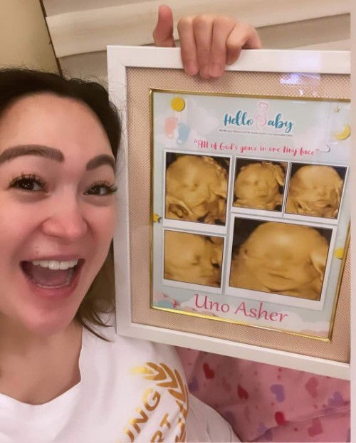 Hello Baby Ultrasound