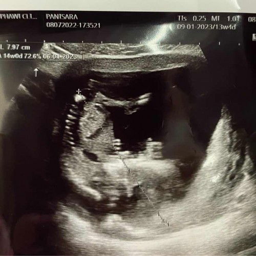 ดูออกไหมคะว่าส่วนไหน