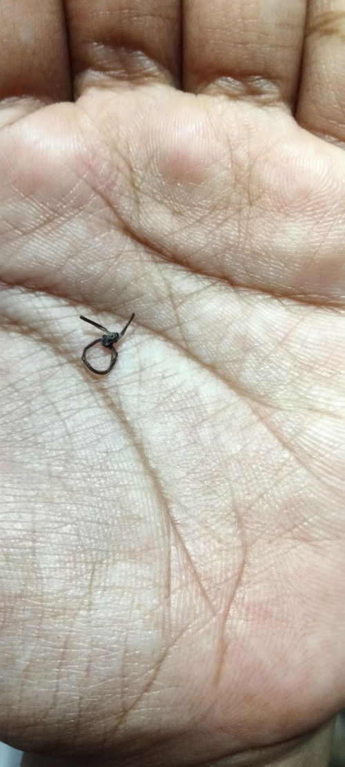 Wajar ga sih bund jahitan copot sprti ini?