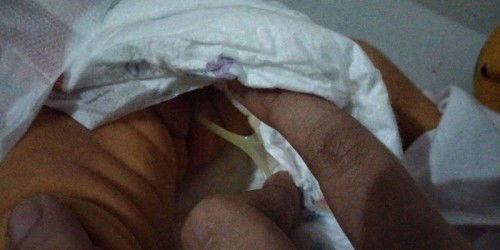 parang sipon sa diaper