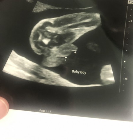 gender baby