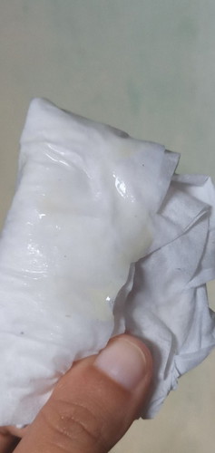 Ini apa ya? Keputihan atau ketuban?