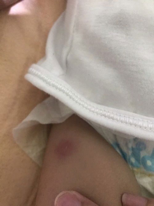 bakuna ni baby maga pRin