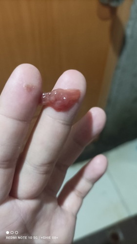 SA mga gumamit Ng evening primrose ganito din po lumabas SA inyo. 1 first day palang po ako nagamit.