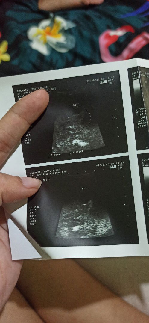 Boy na Kaya mga mommy