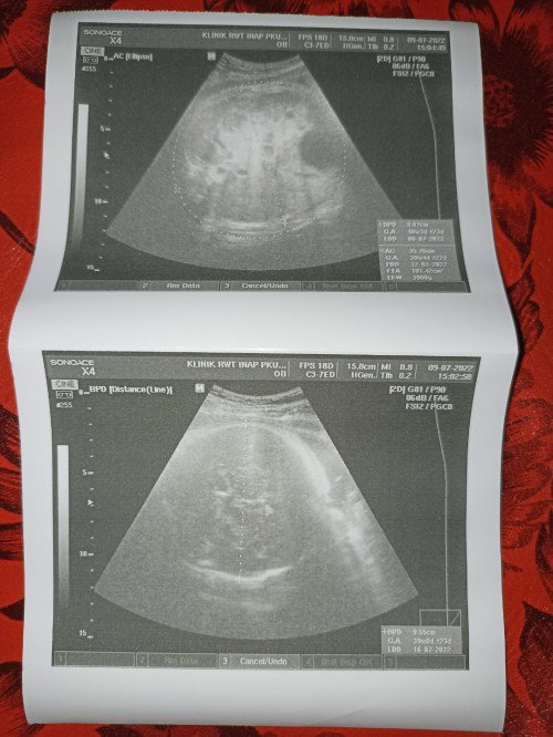 Kepikiran karena lewat HPL