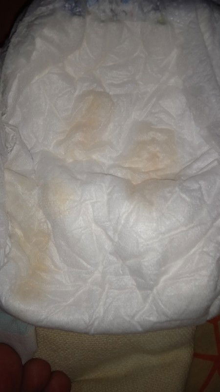 Bayi 4 bulan kurang tidak BAK