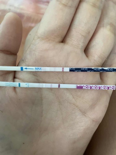 ต้องทำอะไรก่อนดีคะ