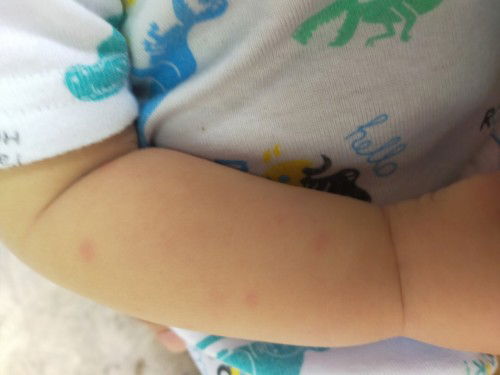 Mga mommy ask ko lng po ano po kaya to? Or anong cream pwede lagay kay baby?