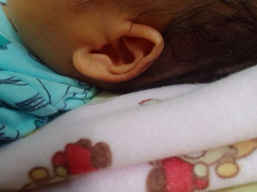 Telinga bayi sering miring..bayi 2 mnggu