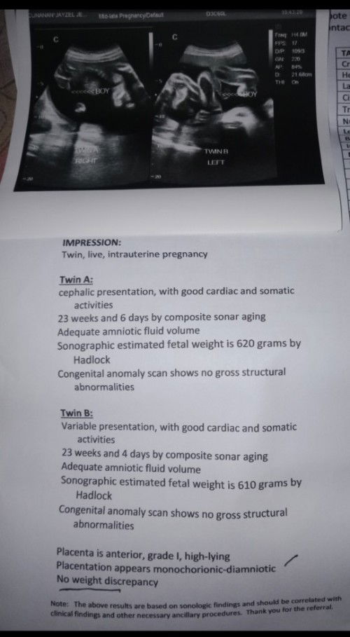 Share ko lang po twins ko.