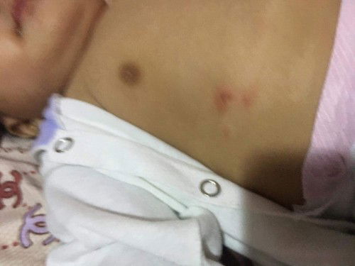 Tanong ko lang po baka po may alam dito kung ano po yung nasa gilid ng baby ko natatakot po kasi ako