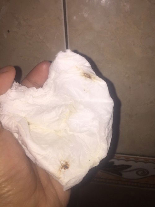 Darah atau flek implantasi