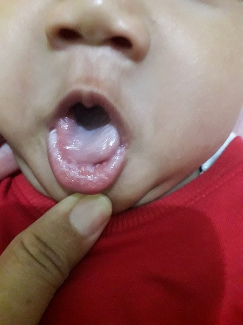 Bibir putih