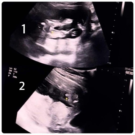 ภาพไหนคือเพศจริงๆของลูกคะ