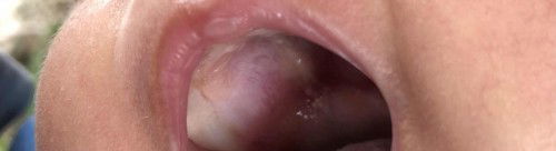 Bintik putih di dlm mulut bayi