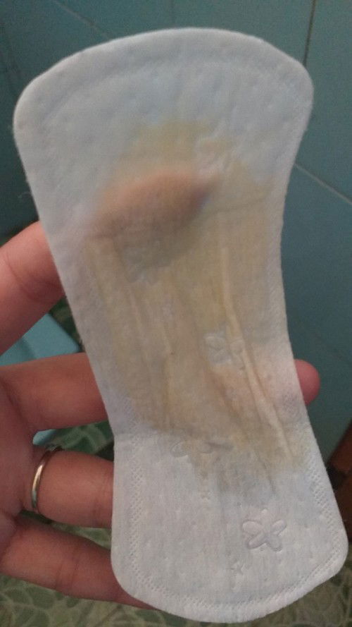 Keputihan yang encer