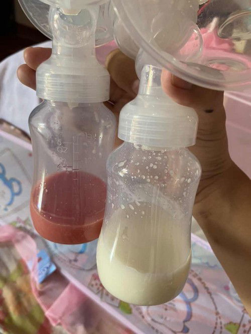 สอบถามแม่ๆค่ะ