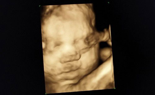 My Baby Sebastian Kalyx 💖