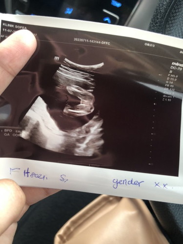 Baby girl or boy ??