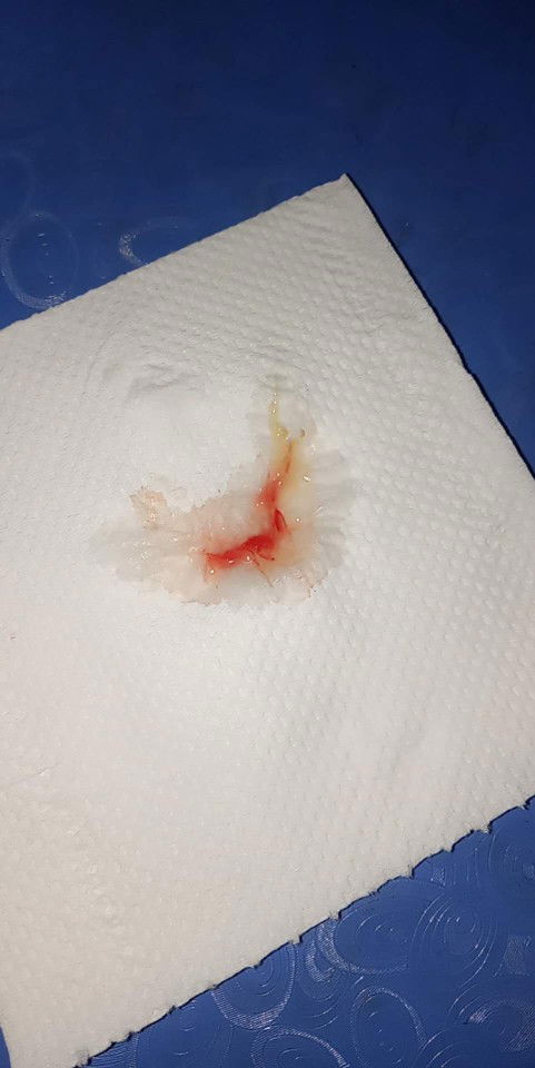 Mga moms sign of labor na po ba 'to? Or gawa lang po ng pag IE sakin kanina?