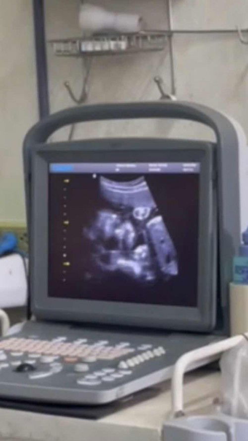 น้องไม่ดิ้นให้ดูเลย