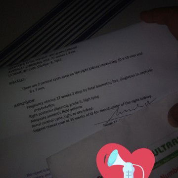 RENAL CORTICAL CYST SA RIGHT KIDNEY NI BABY KO