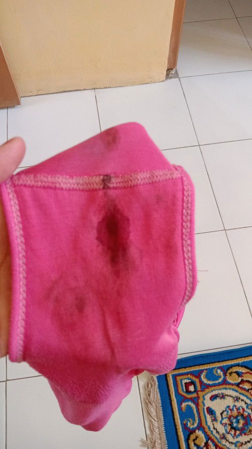 Hamil 6w keluar darah