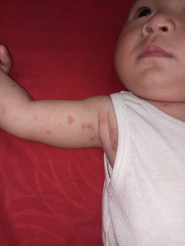 Ada yang tau gk..ini anak saya knp ya bgni gk sembuh2 pdhl udh 3 kli brobat TPI ttp bgni