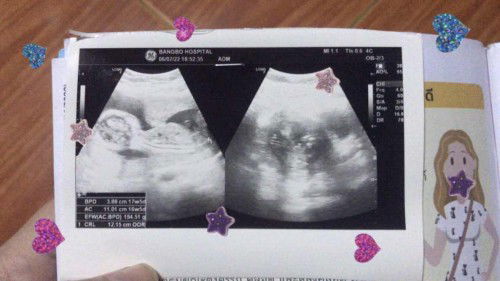 น้องปู้หญิงหรือปู้ชายคะแม่ๆ