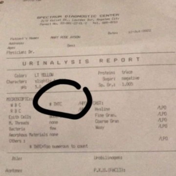 Mataas ba uti kapag naka lagay TNTC?