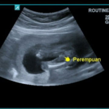 Hasil USG 4 bulan