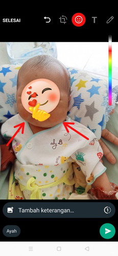 Mau nanya bun , ini kenapa ya pipi/leher anak ku gede sebelah gitu ?π